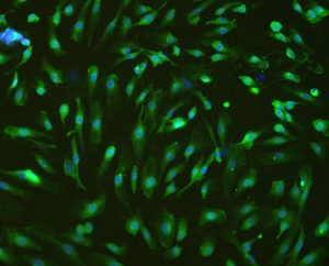 Na obrázku sú zobrazené ľudské pupočníkové žilové endotelové bunky. Bunky sú imunofluorescenčne označené dvoma farbičkami. Modrou farbou svietia jadrá buniek, zelenou farbou je znázornená prítomnosť galektínu-8, ktorý sa nachádza predovšetkým v cytoplazme buniek. Pravdepodobne stimuluje tvorbu nových ciev potrebných pre výživu nádorových buniek a potlačenie jeho biologickej aktivity by mohlo viesť k zníženej tvorbe ciev.