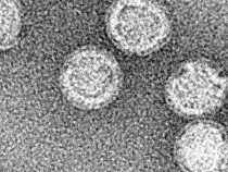 Výskumník neviditeľného vesmíru