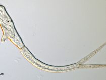 Parazity v ľudskej koži