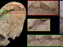 Vražedná úprava hlavy