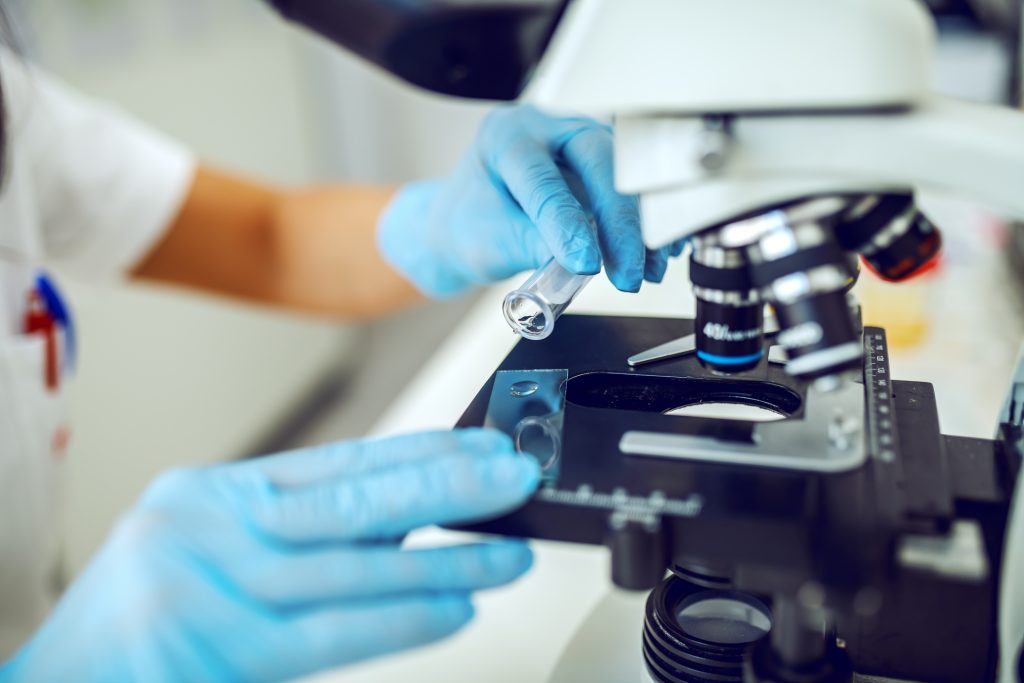 Detailný záber výskumníčky, ktorá kvapká vzorku na sklo mikroskopu.