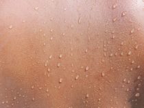 Pot nekvapká, leje sa