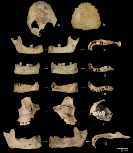 Rôzne ľudské kosti na čiernom pozadí