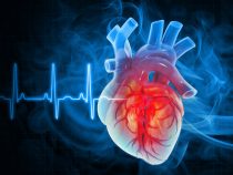 Štyri faktory infarktu