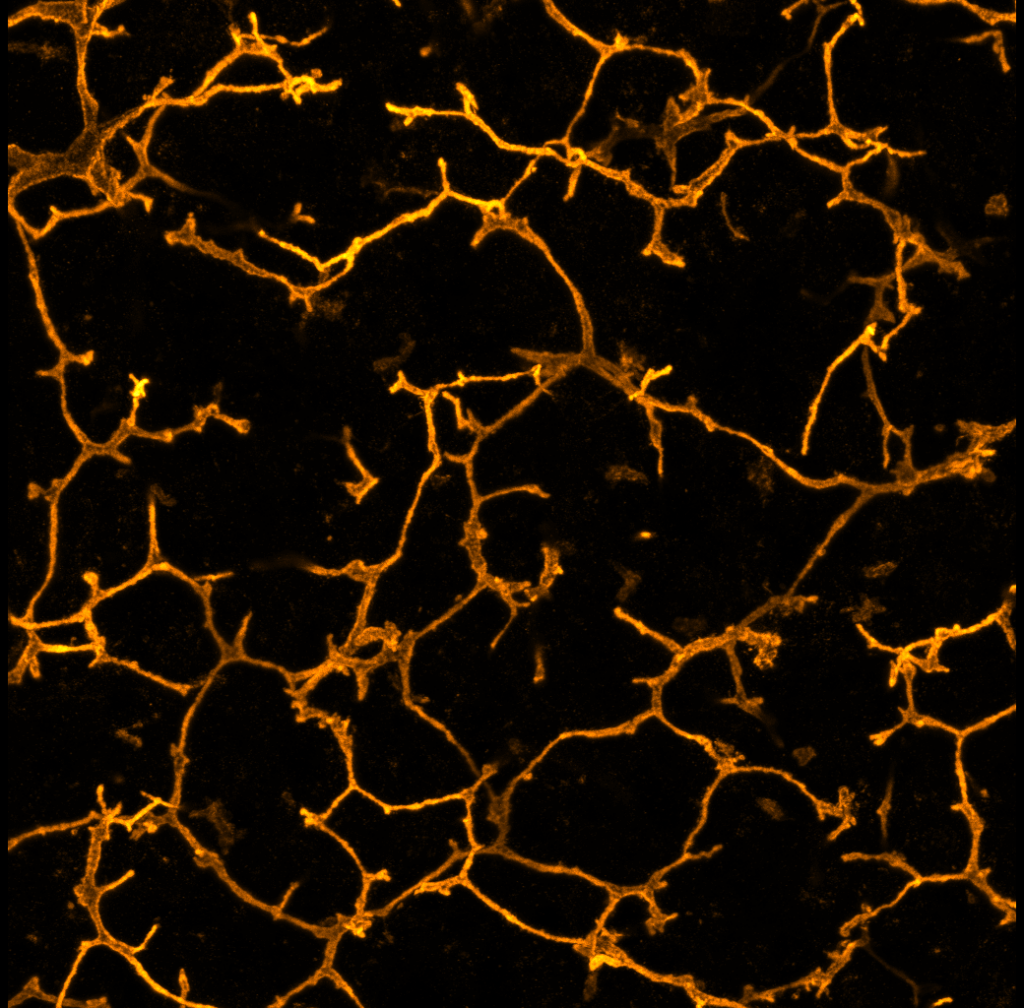 Žlčové kanáliky v pečeni zblízka