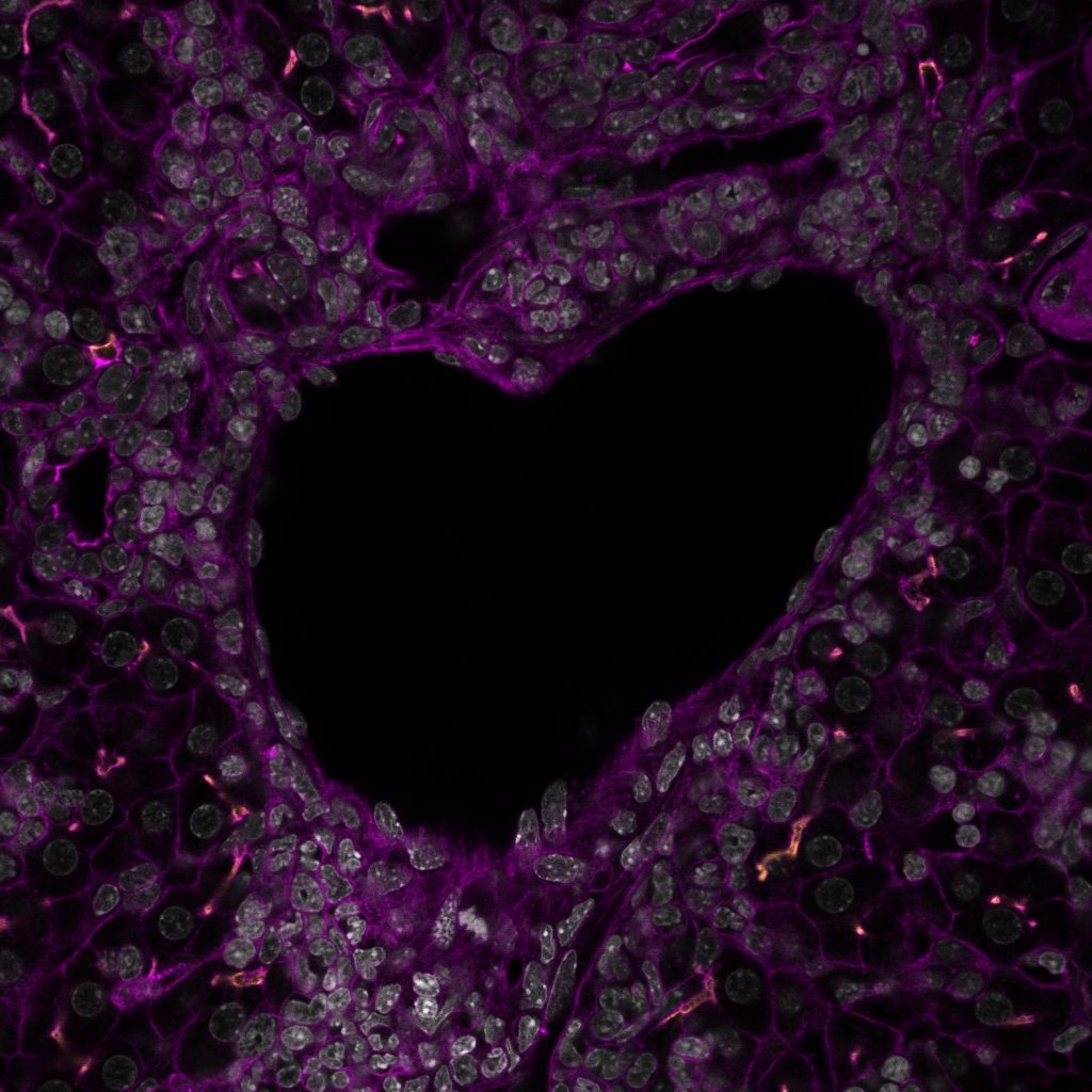 Bunky pečeňového tkaniva v tvare srdca