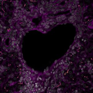 Bunky pečeňového tkaniva v tvare srdca