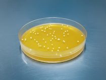 Príbeh kvasiniek: Od kuchyne k Nobelovej cene