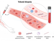 Tekutá biopsia v diagnostike