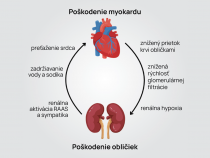 Keď sa srdce a obličky negatívne ovplyvňujú