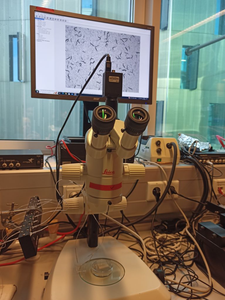 Laboratórny mikroskop pripojený k počítaču, na ktorom sa zobrazuje mikroskopický obraz vzorky