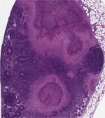 Bunky myší infikovaných baktériou Yersinia pseudotuberculosis. Vedci sa domnievajú, že indukovaný enzým, ktorý objavili v týchto bunkách, pomáha umierajúcim bunkám upozorniť svojich susedov, že ide o infekciu. Foto Pensylvánska univerzita